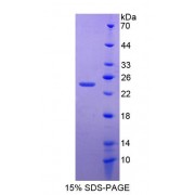 SDS-PAGE analysis of Zinc Finger Homeobox Protein 4 Protein.