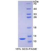 SDS-PAGE analysis of C-C Motif Chemokine Ligand 7 Protein.