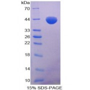 SDS-PAGE analysis of CCL2 Protein.