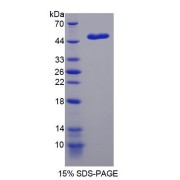 SDS-PAGE analysis of NME5 Protein.