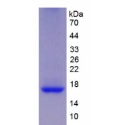 SDS-PAGE analysis of REG1B Protein.