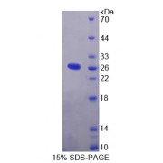 SDS-PAGE analysis of IL1RAPL2 Protein.
