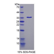 SDS-PAGE analysis of EML2 Protein.