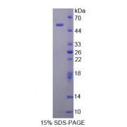 SDS-PAGE analysis of Palate/Lung And Nasal Epithelium Associated Protein.