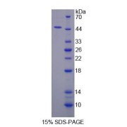 SDS-PAGE analysis of Ovarian Cancer Immuno Reactive Antigen Domain Containing Protein 2 Protein.