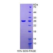 SDS-PAGE analysis of TIE1 Protein.