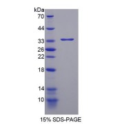 SDS-PAGE analysis of recombinant Human Tyrosine Phosphatase Receptor Type S Protein.