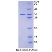 SDS-PAGE analysis of Kinase D1 Protein.