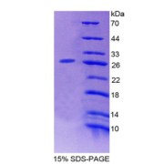 SDS-PAGE analysis of Kinase D2 Protein.