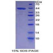 SDS-PAGE analysis of Macrophage Derived Chemokine Protein.