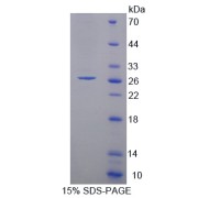 SDS-PAGE analysis of Factor Related Apoptosis Protein.