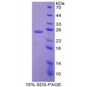 SDS-PAGE analysis of IL6 Protein.