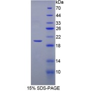 SDS-PAGE analysis of Hemoglobin beta Protein.