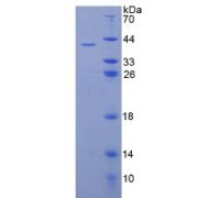 SDS-PAGE analysis of Insulin (INS) Protein.