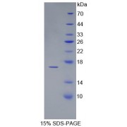 SDS-PAGE analysis of recombinant Human Luteinizing Hormone beta Polypeptide Protein.