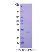 SDS-PAGE analysis of Cystatin 6 Protein.