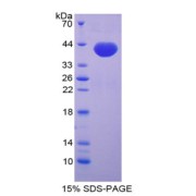 SDS-PAGE analysis of CCL14 Protein.