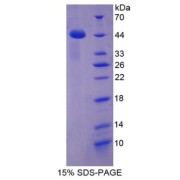 SDS-PAGE analysis of CCL16 Protein.