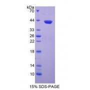 SDS-PAGE analysis of INHA Protein.
