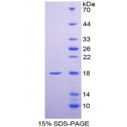 SDS-PAGE analysis of Selectin, Endothelium Protein.