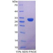 SDS-PAGE analysis of Calretinin Protein.