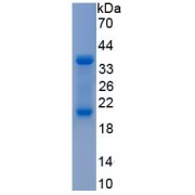 SDS-PAGE analysis of recombinant Human Reelin Protein.