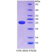 SDS-PAGE analysis of Cylindromatosis Protein.