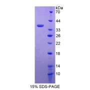 SDS-PAGE analysis of Small Breast Epithelial Mucin Protein.