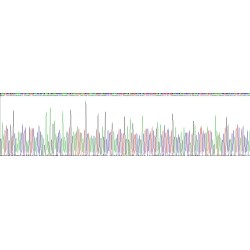 Human Ferrochelatase (FECH) Protein