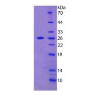 SDS-PAGE analysis of Transgelin 2 Protein.