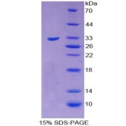 SDS-PAGE analysis of Sorbitol Dehydrogenase Protein.