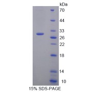 SDS-PAGE analysis of IL17RC Protein.