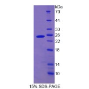 SDS-PAGE analysis of Cytoglobin Protein.