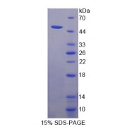 SDS-PAGE analysis of Phospholipase B Protein.