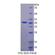 SDS-PAGE analysis of recombinant Human Uroplakin 3A Protein.