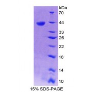 SDS-PAGE analysis of recombinant Human CXCL14 Protein.