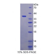 SDS-PAGE analysis of Inter alpha Globulin Inhibitor H1 Protein.