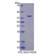 SDS-PAGE analysis of Syntenin 1 Protein.