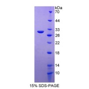 SDS-PAGE analysis of Progesterone Immunomodulatory Binding Factor 1 Protein.