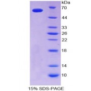 SDS-PAGE analysis of Cluster Of Differentiation 40 Ligand Protein.