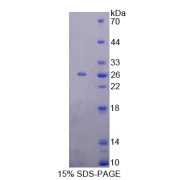 SDS-PAGE analysis of Recoverin Protein.