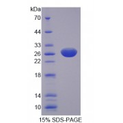 SDS-PAGE analysis of Multiple Endocrine Neoplasia I Protein.