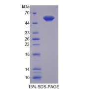 SDS-PAGE analysis of Annexin A11 Protein.