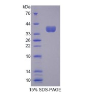 SDS-PAGE analysis of Protocadherin beta 16 Protein.