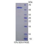 SDS-PAGE analysis of Kallikrein 14 Protein.