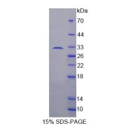 SDS-PAGE analysis of ADAM33 Protein.