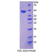 SDS-PAGE analysis of Annexin A10 Protein.