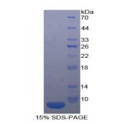 SDS-PAGE analysis of IL18R1 Protein.