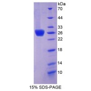 SDS-PAGE analysis of Coxsackie Virus And Adenovirus Receptor Protein.