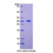 SDS-PAGE analysis of ADAM8 Protein.